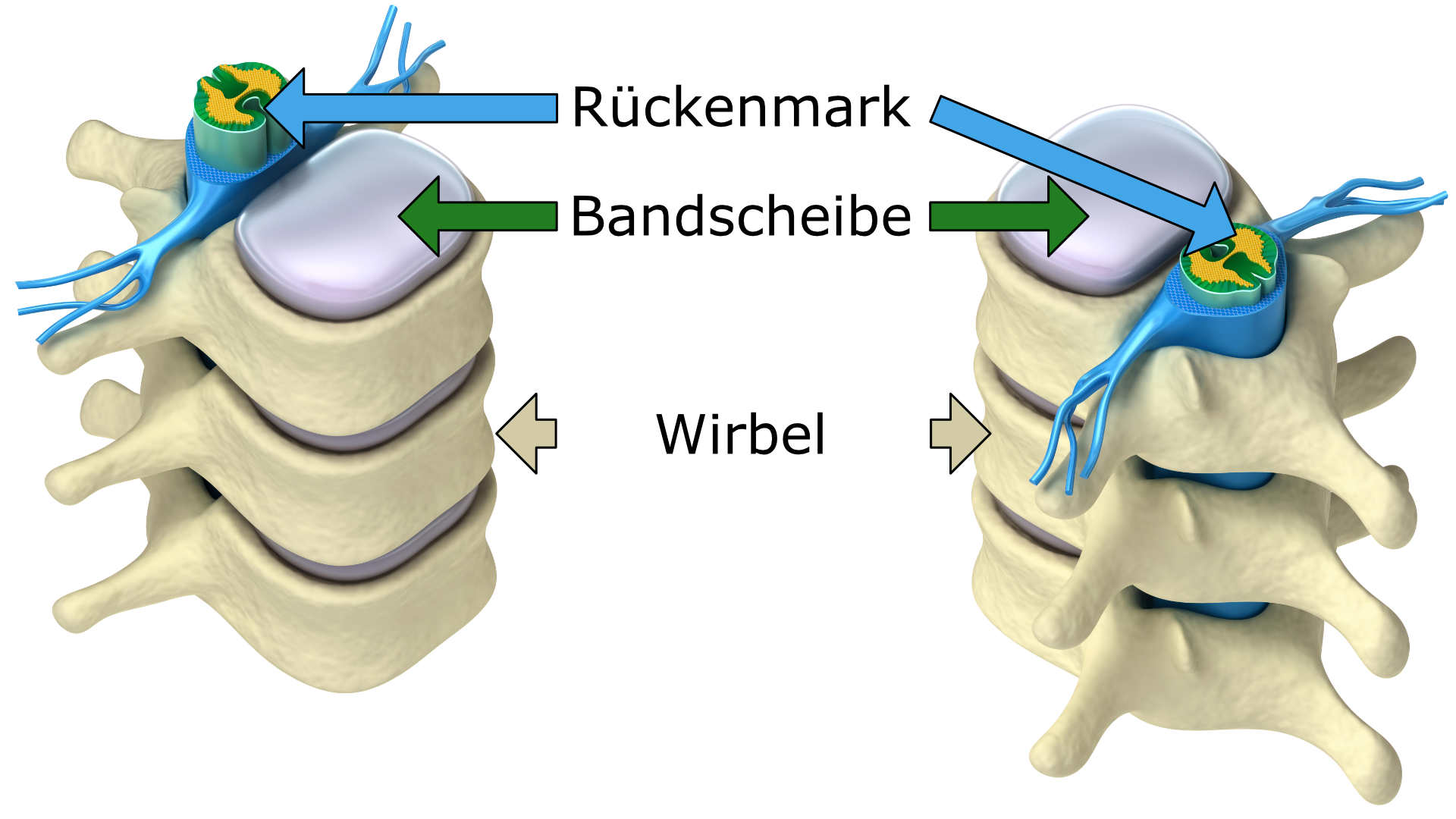 Anatomische Darstellung der Wirbelsäule mit Wirbelnd, Rückenmark und Bandscheiben